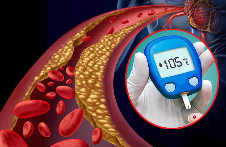 Giảm mỡ máu ở người tiểu đường